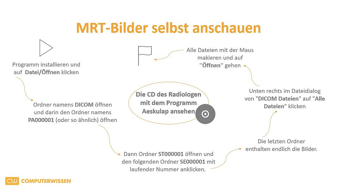 Kann Man Eine Mrt Cd Zu Hause Anschauen So schauen Sie sich Ihre MRT selbst an